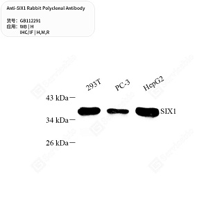 Антитела первичные, поликлональные кролика к SIX1 крысы, мыши, человека, 50 мкл