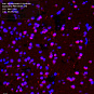 Антитела первичные, поликлональные, Prostaglandin D Synthase (Lipocalin)/PDS, 100 мкл