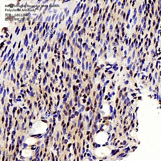 Антитела первичные, поликлональные кролика к Estrogen Receptor beta мыши, 50 мкл