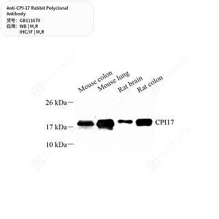 Антитела первичные, поликлональные кролика к CPI-17 крысы, мыши, 50 мкл