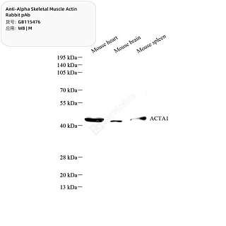 Антитела первичные, поликлональные кролика к Alpha Skeletal Muscle Actin мыши, 100 мкл