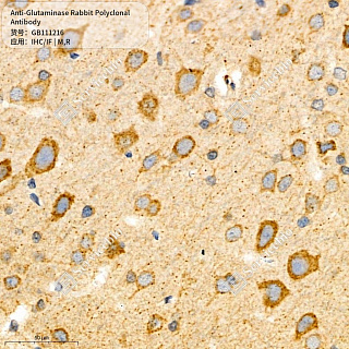Антитела первичные, поликлональные кролика к Glutaminase крысы, мыши, 50 мкл