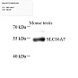 Антитела первичные, поликлональные, MCT2, 100 мкл