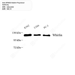 Антитела первичные, поликлональные кролика к DFNB31 человека, 50 мкл