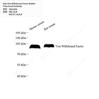 Антитела первичные, поликлональные кролика к Von Willebrand Factor крысы, мыши, человека, 50 мкл
