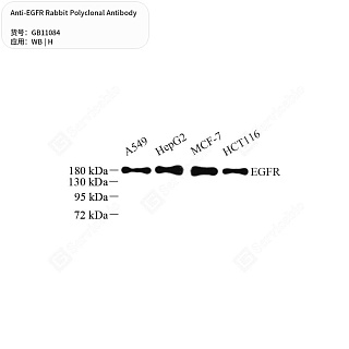 Антитела первичные, поликлональные кролика к EGFR человека, 100 мкл