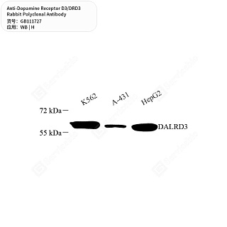 Антитела первичные, поликлональные кролика к Dopamine Receptor D3/DRD3 человека, 50 мкл