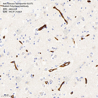 Антитела первичные, поликл. кролика к Glucose Transporter GLUT1 крысы, мыши, человека, 50 мкл