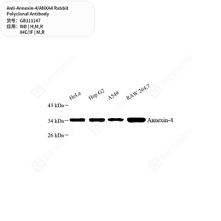 Антитела первичные, поликлональные кролика к Annexin-4/ANXA4 крысы, мыши, человека, 50 мкл