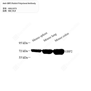 Антитела первичные, поликлональные кролика к GBP2 крысы, мыши, 50 мкл