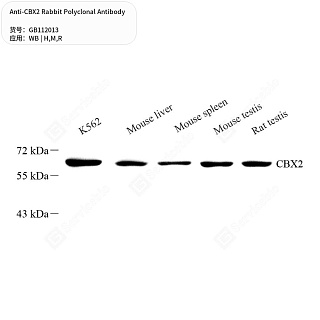 Антитела первичные, поликлональные кролика к CBX2 крысы, мыши, человека, 50 мкл