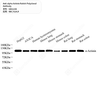 Антитела первичные, поликлональные кролика к alpha Actinin крысы, мыши, человека, 50 мкл