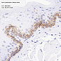 Антитела первичные, моноклональные, Cytokeratin 6, 100 мкл