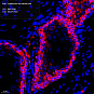 Антитела первичные, поликлональные, Cytokeratin 6a, 100 мкл