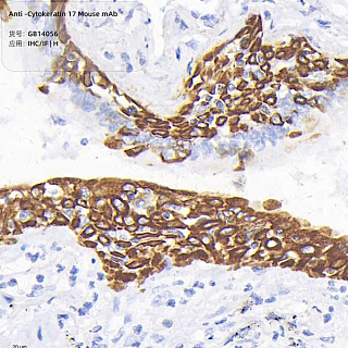 Антитела первичные, моноклональные мыши к Cytokeratin 17 человека, 50 мкл