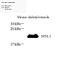 Антитела первичные, поликлональные, MYL1, 100 мкл