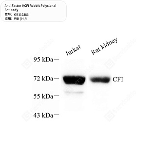 Антитела первичные, поликлональные кролика к Factor I/CFI крысы, человека, 50 мкл
