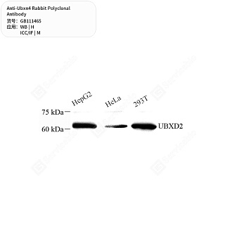 Антитела первичные, поликлональные кролика к Ubxn4 мыши, человека, 50 мкл