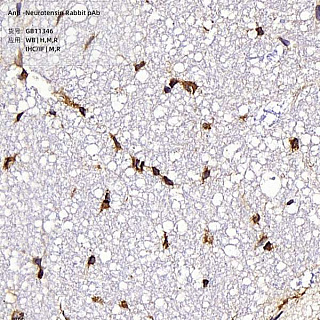 Антитела первичные, поликлональные кролика к Neurotensin крысы, мыши, человека, 100 мкл