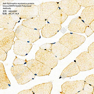 Антитела первичные, поликл. кролика к Dystrophia myotonica protein kinase/DMPK крысы, мыши, 50 мкл