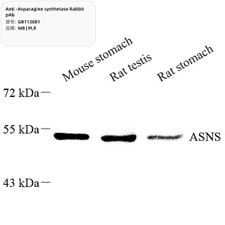 Антитела первичные, поликлональные кролика к Asparagine synthetase крысы, мыши, 100 мкл