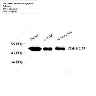 Антитела первичные, поликлональные кролика к ZDHHC23 мыши, человека, 50 мкл