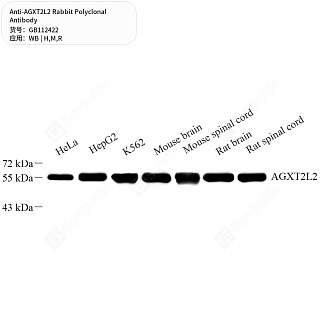 Антитела первичные, поликлональные кролика к AGXT2L2 крысы, мыши, человека, 50 мкл