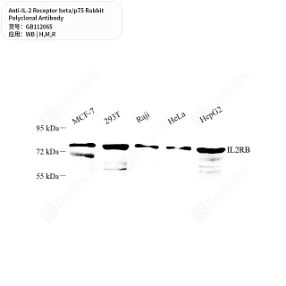 Антитела первичные, поликлональные кролика к IL-2 Receptor beta/p75 крысы, мыши, человека, 50 мкл