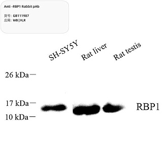 Антитела первичные, поликлональные кролика к RBP1 крысы, человека, 100 мкл