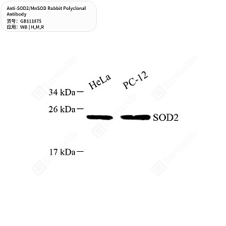 Антитела первичные, поликлональные кролика к SOD2/MnSOD крысы, мыши, человека, 50 мкл