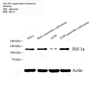 Антитела первичные, поликлональные кролика к HIF-1 alpha человека, 50 мкл