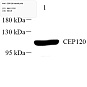 Антитела первичные, поликлональные, CEP120, 100 мкл