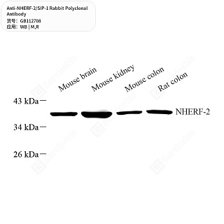 Антитела первичные, поликлональные кролика к NHERF-2/SIP-1 крысы, мыши, 50 мкл