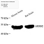 Антитела первичные, поликлональные, Beta Arrestin 2, 100 мкл