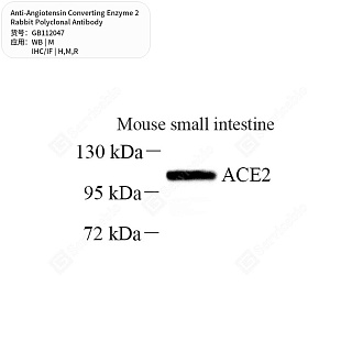 Антитела первичные, поликл. кролика к Angiotensin Converting Enzyme 2 крысы, мыши, человека, 50 мкл
