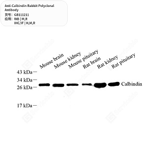 Антитела первичные, поликлональные кролика к Calbindin крысы, мыши, человека, 50 мкл