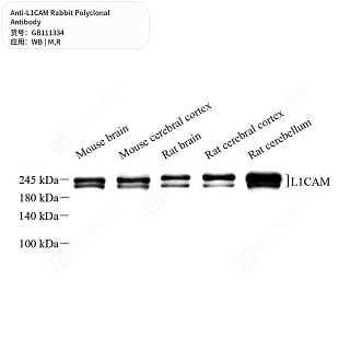 Антитела первичные, поликлональные кролика к L1CAM крысы, мыши, 50 мкл