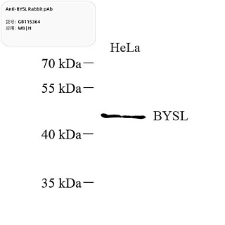Антитела первичные, поликлональные кролика к BYSL человека, 100 мкл