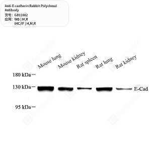Антитела первичные, поликлональные кролика к E-cadherin крысы, мыши, человека, 50 мкл
