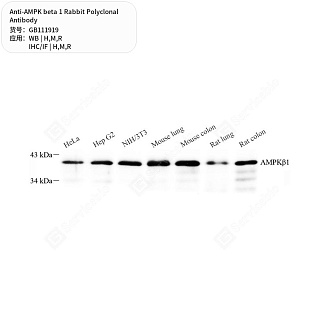 Антитела первичные, поликлональные кролика к AMPK beta 1 крысы, мыши, человека, 50 мкл