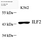 Антитела первичные, поликлональные, ILF2/NF45, 100 мкл