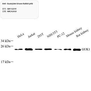 Антитела первичные, поликлональные кролика к Guanylate kinase крысы, мыши, человека, 100 мкл