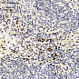 Антитела первичные, поликлональные, CDK2, 100 мкл