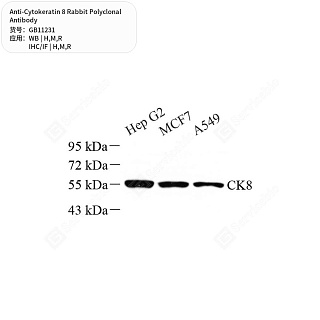 Антитела первичные, поликлональные кролика к Cytokeratin 8 крысы, мыши, человека, 50 мкл