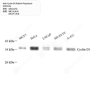 Антитела первичные, поликлональные кролика к Cyclin D1 крысы, мыши, человека, 50 мкл