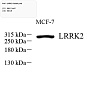 Антитела первичные, поликлональные, LRRK2, 100 мкл