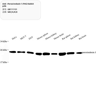 Антитела первичные, поликлональные кролика к Peroxiredoxin 1/PAG крысы, мыши, человека, 100 мкл