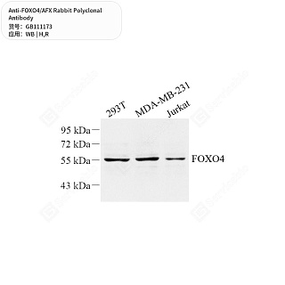 Антитела первичные, поликлональные кролика к FOXO4/AFX крысы, человека, 50 мкл