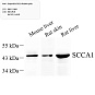 Антитела первичные, поликлональные, SerpinB3/SCCA, 100 мкл