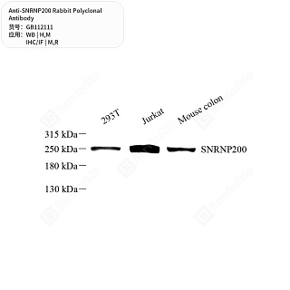 Антитела первичные, поликлональные кролика к SNRNP200 крысы, мыши, человека, 50 мкл